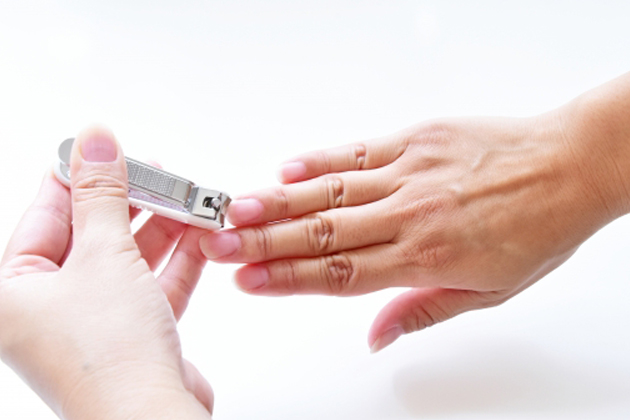 ��������}���̕��@���摜�ŉ���I���S��G�X�|�b�g���h��������@�Ƃ́H